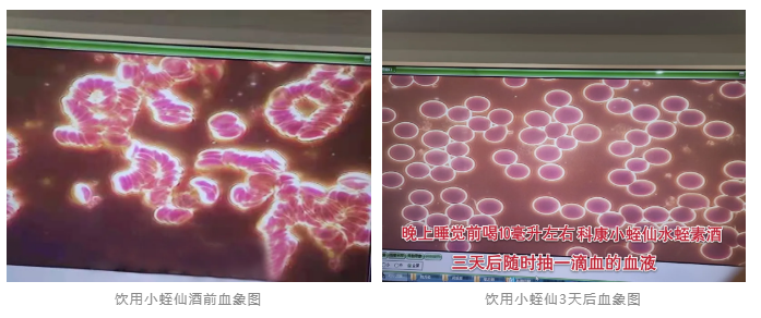 水蛭素、小蛭仙酒、醬香水蛭酒