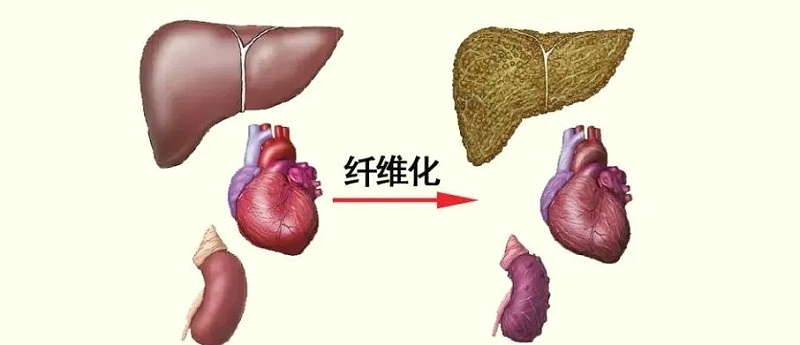 水蛭素、活血化瘀、纖維化