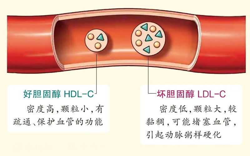 水蛭素、膽固醇、壯醫(yī)水蛭療法培訓(xùn)