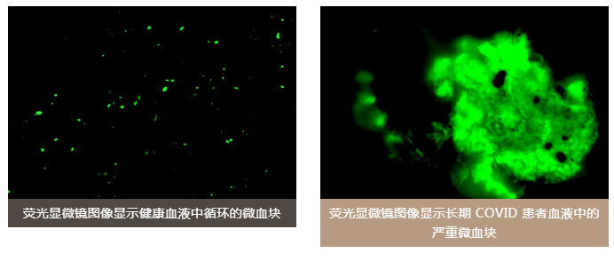 水蛭素、老年癡呆、前列腺、陽康