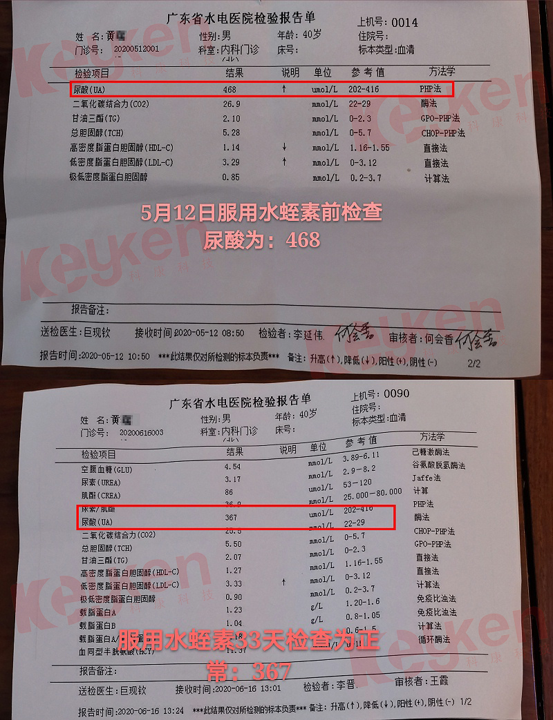 水蛭素、尿酸、痛風(fēng)