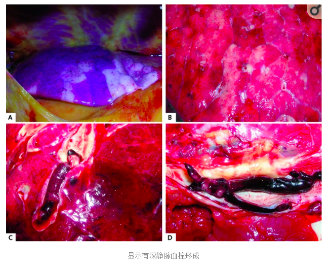 水蛭素、陽(yáng)康、烏梅、壯醫(yī)水蛭療法