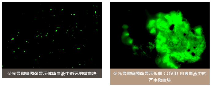 水蛭素、陽(yáng)康、烏梅、壯醫(yī)水蛭療法