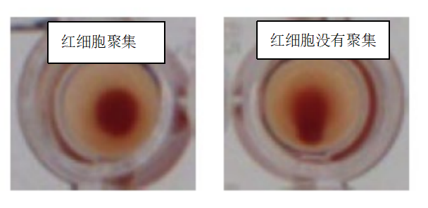 水蛭素、新冠病毒、壯醫(yī)水蛭療法