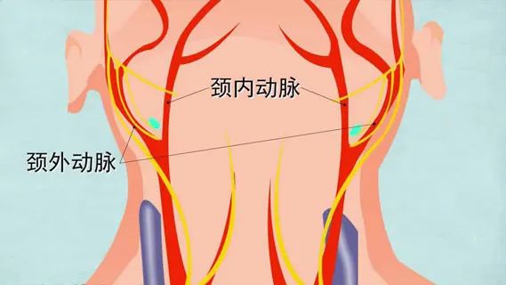 水蛭素、血管堵塞、粥樣硬化