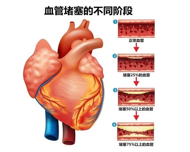 壯醫(yī)水蛭療法，天然水蛭素